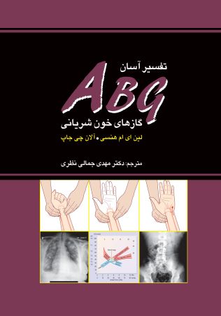 تفسیر آسان ABG گازهای خونی شریانی